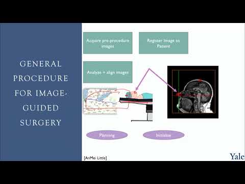 5.3 | GPS for Your Brain? The IGNS Project Explained! Medical Software Course Episode cover