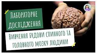 Лабораторне дослідження. Вивчення спинного та головного мозку людини