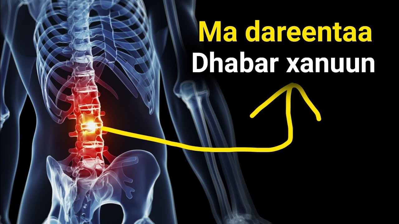 Ma dareentaa in dhabarkaada Soo qaloocsamay ama Soo godmay ?