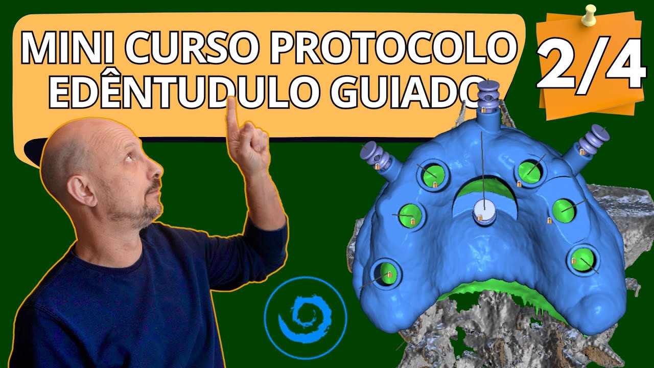 Mini curso completo como desenhar guia cirúrgico para edêntulo total no BlueSkyBio 2 4