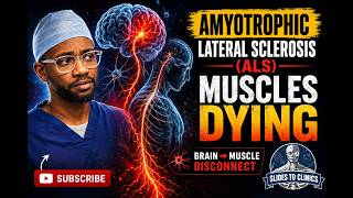ALS Explained | Symptoms, Causes & Progression