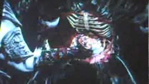 Sub Zero 49/53% X-Ray Combos - Mortal Kombat 9 Demo