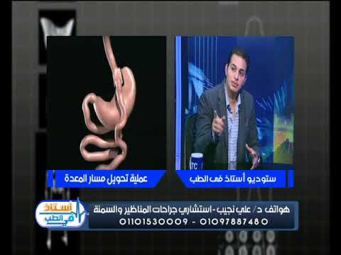 باالفيديو تعرف علي عمليه تحويل المسار لعلاج السمنه الدهون على الكبد