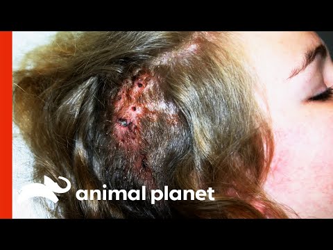 Doctor Extracts 212 Living Larvae From Girl's Head | Monsters Inside Me