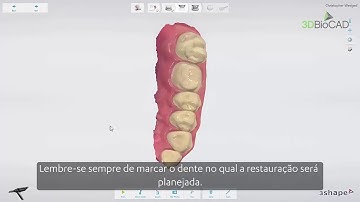 3DBioCAD - 3Shape TRIOS Design Studio Overview