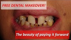 An Amazing Time lapse to a Beautiful Smile