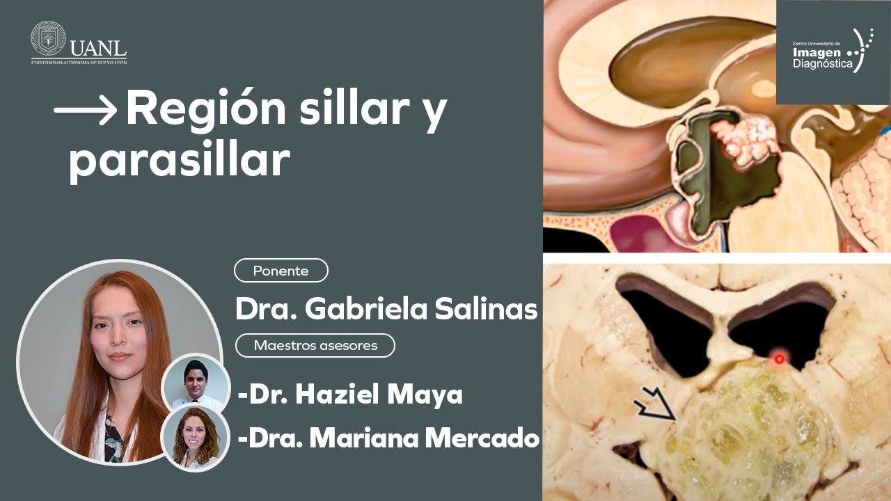 Región sillar y parasillar por la Dra. Gabriela Salinas. - YouTube