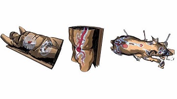 Illustrative Multi-volume Rendering for PET/CT Scans