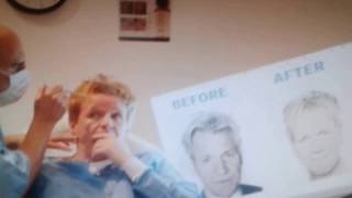 Gordon Ramsay insults his Doc for not being fast enough with injecting the botox in his front head!