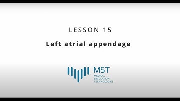 MST Masterclass - Lesson 15 - Left atrial appendage