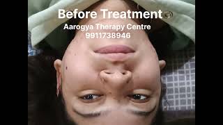 Hijama / wet Cupping #hijama #physiotherapist #face #beautiful #beauty #skincare #skinhealth #skin 