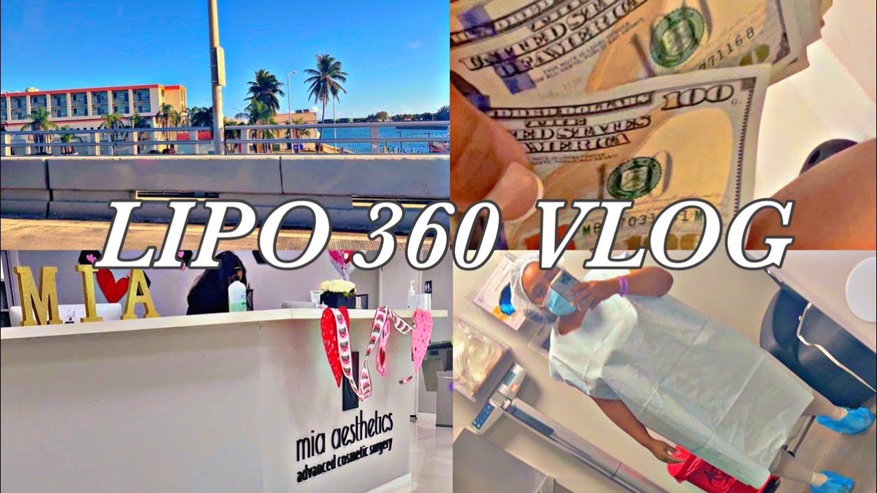 SHUNTI WENT TO MIAMI AND GOT LIPO 360 AT MIA AESTHETICS|DR.GIORGIS