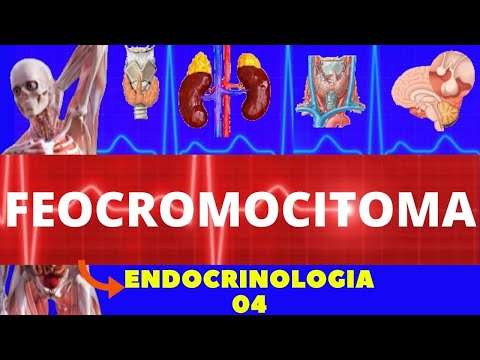 Vídeo: Por que hipotensão ortostática no feocromocitoma?