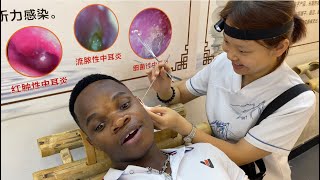Black Man Tried Chinese EarWax Extraction/ Ear Picking Massage
