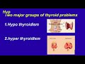 hypothyroidism and hyperthyroidism presentation /Dr hima reddy