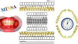 Odontograma MINSA, e historia clínica