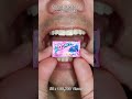 Most Satisfying Candy & Chocolate ASMR 🍫🍬 #DoctorTristanPeh #ASMR