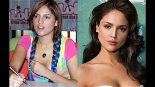 Eiza Gonzalez Before/After Plastic Surgery!