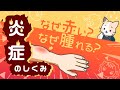 蚊に刺されるとなぜ腫れる？炎症のしくみ　～炎症の4徴候、慢性炎症、抗炎症薬～