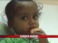 Baby gets liver transplant first in india
