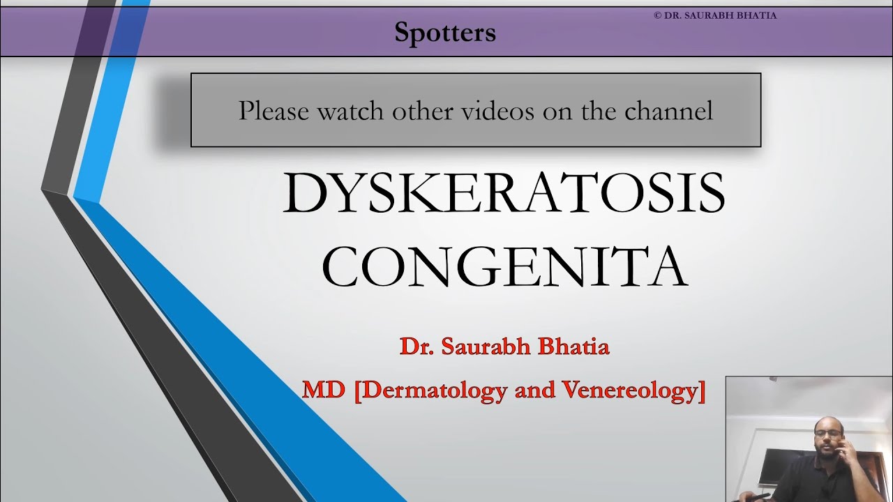 Dyskeratosis Congenita