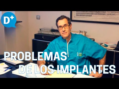 Vídeo: Problemas De Implantes Dentales Tempranos Y Tardíos