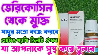 R42 | ভেরিকোসিল সুস্থতায় সেরা তিনটি জার্মানি ঔষধ | ভেরিকোসিল থেকে মুক্তির কার্যকরী ঔষধ | Homeopathy