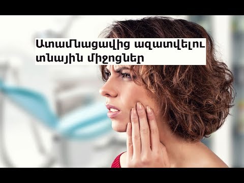 Video: Ինչպես քայլել օրական 10.000 քայլ (նկարներով)