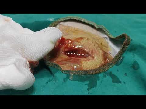 Video: Cysts Katika Urethra Huko Ferrets