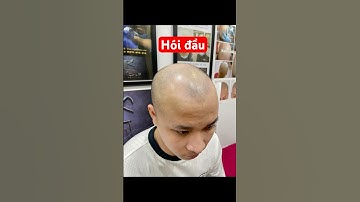 Xăm chân tóc khắc phục hói cho em trai lấy vợ #cấytóc #hóiđầu #xămchântóc