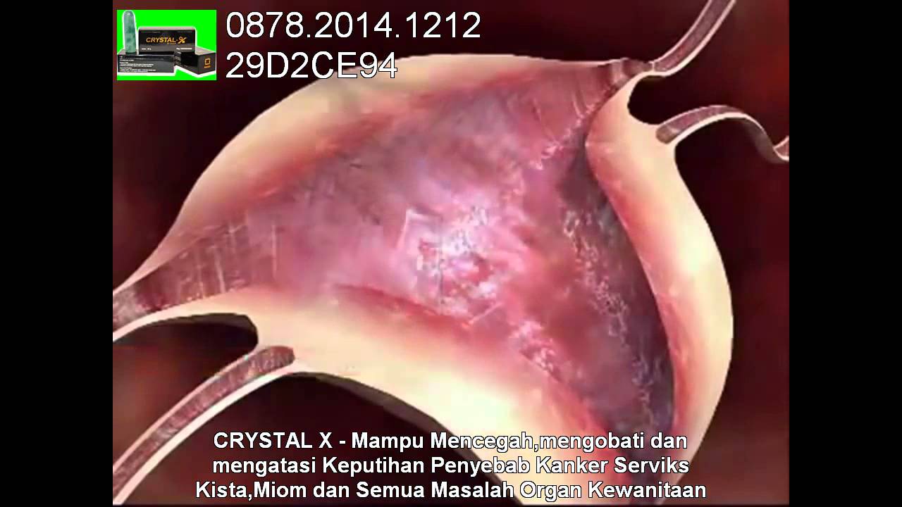 Sistem Reproduksi Wanita