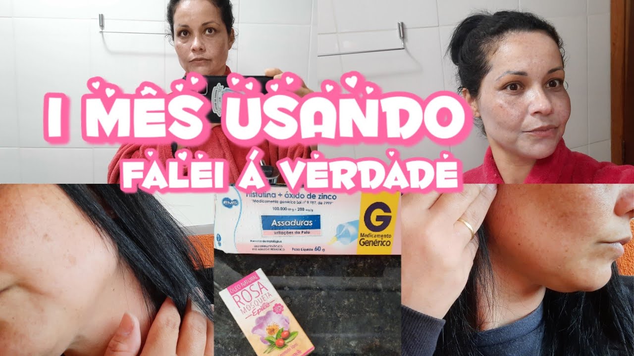 Resultado de 1 mês Usando Nistatina +Óleo De Rosa Mosqueta/Pra Clarear ...