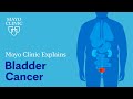 Mayo Clinic Explains Bladder Cancer