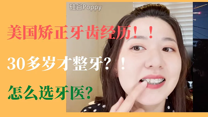 三十多岁的老姐姐为什么决定整牙？美国硅谷湾区矫正牙齿 |怎么选的医生？ |拔没拔牙？ |费用是多少？ |打牙钉痛不痛？ |后悔嘛？ |我的牙套日记 |正畸or正颌，我为什么选择正畸？ - 天天要闻
