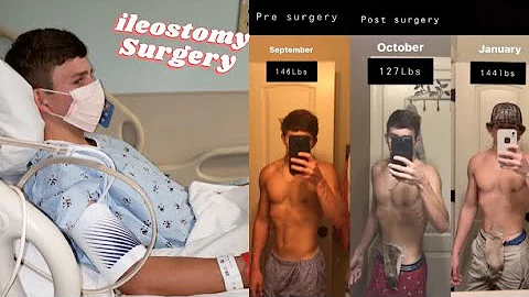 Getting Diagnosed with Crohns Disease
