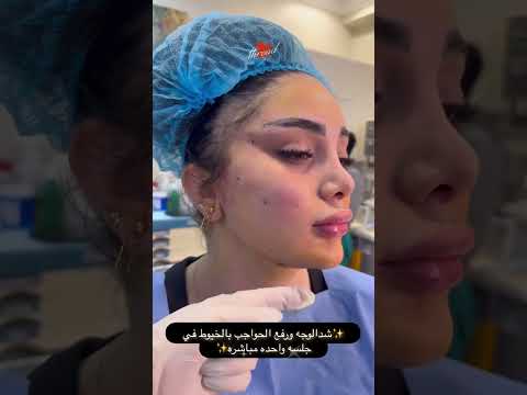 شد الوجه ورفع الحواجب بالخيوط في جلسة واحدة هي تقنية رائعة تجمع بين فعالية وسرعة النتائج