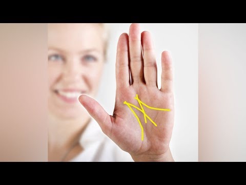 Video: Was Bedeuten Muttermale In Der Handfläche?