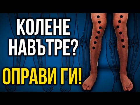 Видео: Как да коригирам ходенето с извадени крака?