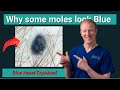 That Blue Mole Could Save Your Life — Here's Why