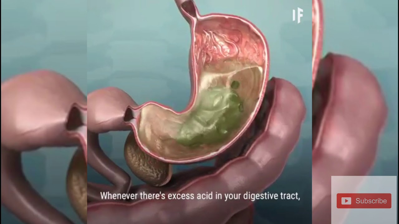 What if you jumped into a pool full of STOMACH ACID 😷😨 YouTube