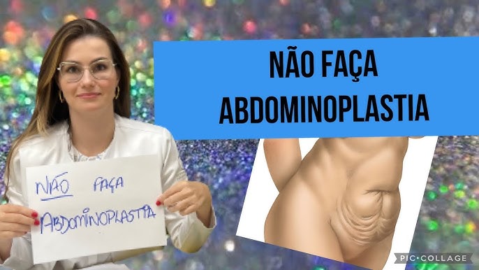 Lipoaspiração Abdominal (na Barriga) Feminina X Lipoescultura