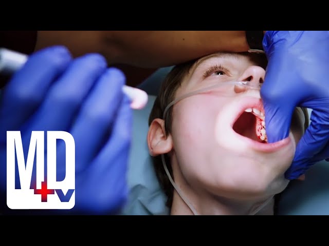 Poor Oral Hygiene Ends in Brain Infection | Chicago Med | MD TV class=