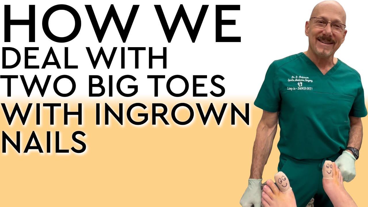 How We Deal With Two Big Toes with Ingrown Nails - YouTube