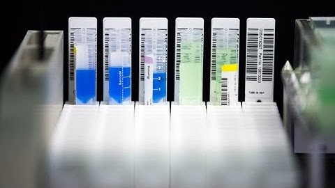 How DNA Databases Can Help Diagnose Rare Diseases