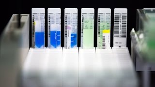 How Dna Databases Can Help Diagnose Rare Diseases