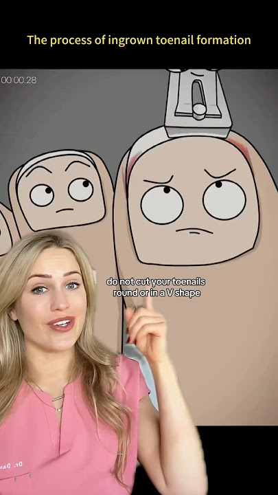 How to properly cut your toenails