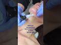 Dont stop at the jawline, treat your neck too! #microneedling #collagen #antiaging #lakelandflorida
