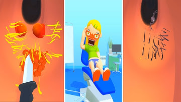 Earwax Clinic in Max Level iOS,Android Gameplay Walkthrough All Trailers Update Game Mobile LKVOIEUA