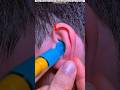 The boy can't hear