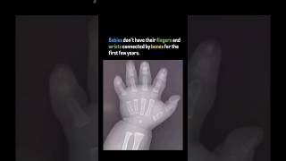 Babies don't have their fingers and wrists connected by bones for the first few years.